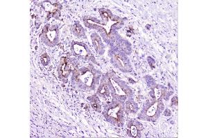 IHC analysis of TANK using anti-TANK antibody (ABIN6719508). (TANK Antikörper)