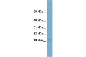 WB Suggested Anti-NOLA3  Antibody Titration: 0. (Nop10 Antikörper  (Middle Region))