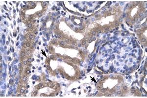 Human kidney; KIN antibody - middle region in Human kidney cells using Immunohistochemistry (KIN Antikörper  (Middle Region))