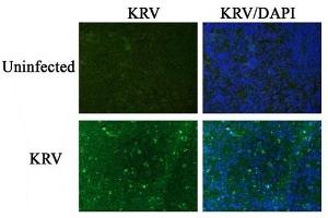 Image kindly submitted by Dr. (Krv-Vp1/Krv-Vp2 (AA 501-582) Antikörper)