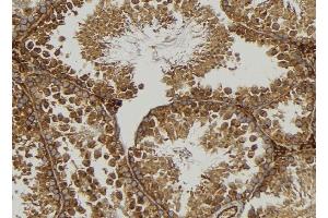 ABIN6277106 at 1/100 staining Mouse testis tissue by IHC-P.