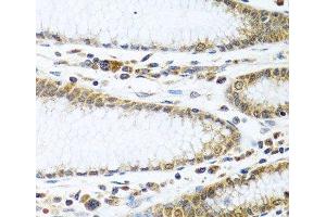 Immunohistochemistry (Paraffin-embedded Sections) (IHC (p)) image for anti-Interferon-Induced Protein 44 (IFI44) antibody (ABIN7264239)