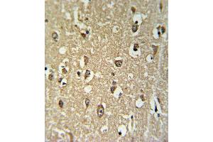 Immunohistochemistry (Paraffin-embedded Sections) (IHC (p)) image for anti-Cholinergic Receptor, Nicotinic, alpha 3 (Neuronal) (CHRNA3) (AA 25-52), (N-Term) antibody (ABIN651212)