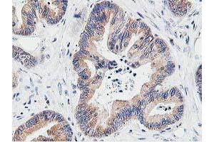 Image no. 10 for anti-Leucine Carboxyl Methyltransferase 1 (LCMT1) antibody (ABIN1499107) (LCMT1 Antikörper)