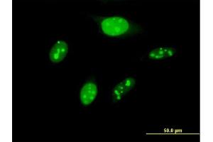 Immunofluorescence of purified MaxPab antibody to BYSL on HeLa cell.