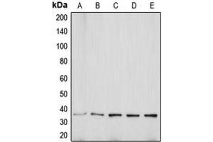 Western blot analysis of Aquaporin 5 expression in MCF7 (A), Jurkat (B), SP2/0 (C), PC12 (D), KNRK (E) whole cell lysates.