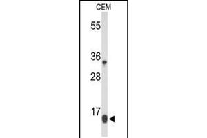 Western blot analysis of DIRAS1 Antibody in CEM cell line lysates (35ug/lane)