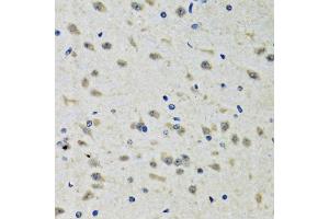 Immunohistochemistry of paraffin-embedded rat brain using CLIC1 antibody. (CLIC1 Antikörper)