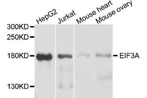 Western blot analysis of extracts of A2058 cell line, using EIF3A antibody. (EIF3A Antikörper  (AA 1-250))