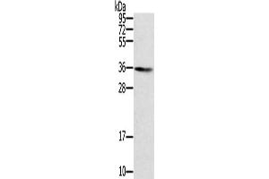 Gel: 8 % SDS-PAGE, Lysate: 40 μg, Lane: Human normal liver tissue, Primary antibody: ABIN7131123(SNX11 Antibody) at dilution 1/300, Secondary antibody: Goat anti rabbit IgG at 1/8000 dilution, Exposure time: 5 minutes (SNX11 Antikörper)