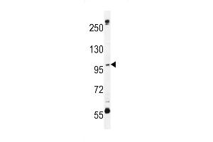 C Antibody (N-term) (ABIN654933 and ABIN2844576) western blot analysis in MDA-M cell line lysates (35 μg/lane). (SWT1 Antikörper  (N-Term))