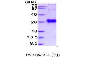 IGFBP6 Protein (AA 26-238) (His tag)