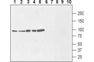 Western blot analysis of rat brain membranes (lanes 1 and 6), mouse brain lysate (lanes 2 and 7), human MCF-7 breast adenocarcinoma cells (lanes 3 and 8), human U-87 MG glioblastoma cells (lanes 4 and 9) and human THP-1 acute monocytic leukemia cells (lanes 5 and 10): - 1-5.
