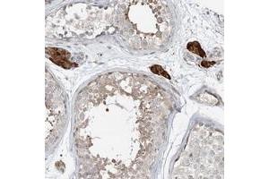 Immunohistochemical staining of human testis with CXXC5 polyclonal antibody  shows strong cytoplasmic positivity in Leydig cells. (CXXC5 Antikörper)