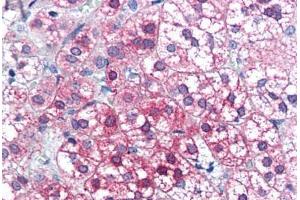 Human Adrenal (formalin-fixed, paraffin-embedded) stained with AXIN1 antibody ABIN351463 at 3. (Axin Antikörper  (AA 850-862))