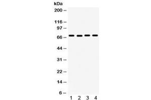 Western blot testing of 1) rat testis, 2) mouse testis, 3) human HeLa and 4) human HepG2 lysate with FMRP antibody.