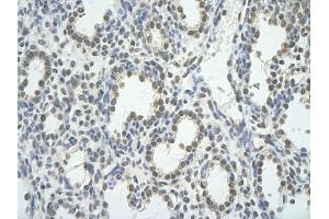 Rabbit Anti-BRD7 antibody         Paraffin Embedded Tissue:  Human Lung    cell Cellular Data:  alveolar cell    Antibody Concentration:  4.