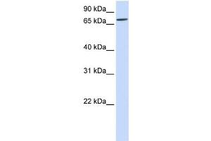 WB Suggested Anti-IL1RAPL2 Antibody Titration:  0. (IL1RAPL2 Antikörper  (Middle Region))