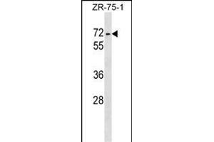 ZKSCAN1 Antibody (Center) (ABIN1538154 and ABIN2848860) western blot analysis in ZR-75-1 cell line lysates (35 μg/lane). (ZKSCAN1 Antikörper  (AA 238-265))
