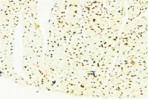 ABIN6276361 at 1/100 staining Mouse liver tissue by IHC-P. (CDKN1B Antikörper  (Internal Region))