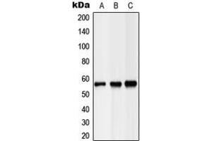 Western blot analysis of Hepatic Lipase expression in HEK293T (A), NIH3T3 (B), H9C2 (C) whole cell lysates. (LIPC Antikörper  (Center))