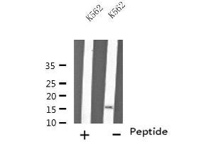 Western Blotting (WB) image for anti-Myosin Light Chain 6, Alkali, Smooth Muscle and Non Muscle (MYL6) (Internal Region) antibody (ABIN6257808)
