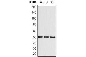 Western blot analysis of GLUT4 expression in A549 (A), HeLa (B), NIH3T3 (C) whole cell lysates.