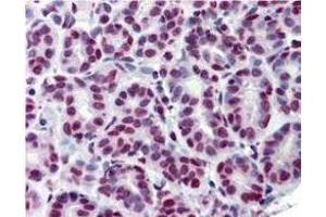 Immunohistochemistry using  Immunochemicals Anti-STAT5 pY694 monoclonal antibody shows detection of phosphorylated STAT5 pY694 in human breast tissue (40X).