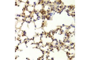 Immunohistochemistry of paraffin-embedded Mouse lung using TAF1C antibody at dilution of 1:100 (x400 lens).