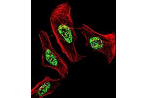 Fluorescent confocal image of Hela cell stained with NR2C2 Antibody (C-term) (ABIN1537335 and ABIN2838328). (TR4 Antikörper  (C-Term))