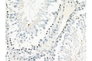 Phospho-PYK2 (Tyr881) Antibody at 1/100 staining Rat testis tissue by IHC-P.