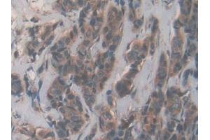 Immunohistochemistry (IHC) image for anti-NADH Dehydrogenase (Ubiquinone) 1, alpha/beta Subcomplex, 1, 8kDa (NDUFAB1) (AA 5-129) antibody (ABIN7439897)