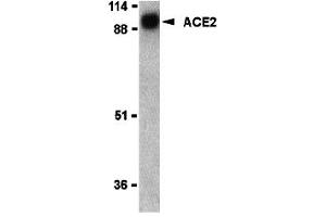 Western Blotting (WB) image for anti-Angiotensin I Converting Enzyme 2 (ACE2) (N-Term) antibody (ABIN1031210) (ACE2 Antikörper  (N-Term))