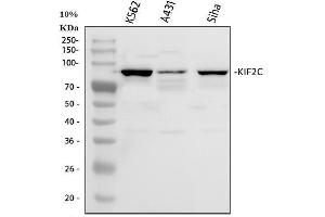 Western blot analysis of MCAK using anti-MCAK antibody (ABIN3043278). (KIF2C Antikörper  (AA 531-725))