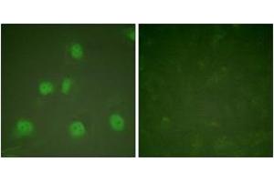 Immunofluorescence analysis of HeLa cells, using Cullin 1 Antibody. (Cullin 1 Antikörper  (AA 727-776))