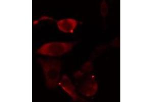 ABIN6277002 staining Hela cells by IF/ICC. (TBXAS1 Antikörper  (N-Term))