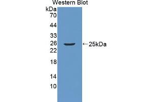 Detection of Recombinant RGS5, Mouse using Polyclonal Antibody to Regulator Of G Protein Signaling 5 (RGS5) (RGS5 Antikörper  (AA 1-181))