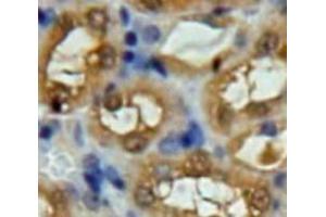 IHC-P analysis of Kidney tissue, with DAB staining. (UCHL5 Antikörper  (C-Term))