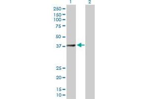 Western Blot analysis of SUCLG2 expression in transfected 293T cell line by SUCLG2 MaxPab polyclonal antibody. (SUCLG2 Antikörper  (AA 1-384))
