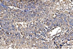 IHC analysis of HMGCS2 using anti-HMGCS2 antibody (ABIN7599435).