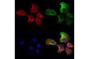 ABIN6259812 and ABIN6272986 staining Hela cells by IF/ICC. (ADRM1 Antikörper  (Internal Region))