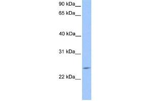 WB Suggested Anti-PTTG2 Antibody Titration:  0. (PTTG2 Antikörper  (Middle Region))