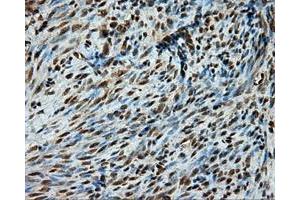 Immunohistochemical staining of paraffin-embedded liver tissue using anti-PSMC3 mouse monoclonal antibody. (PSMC3 Antikörper)