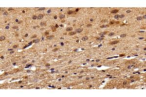 Immunohistochemistry (IHC) image for anti-Ionized Calcium-binding Adapter Molecule 1 (IBA1) (AA 1-147) antibody (ABIN7427558)