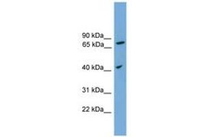 Image no. 1 for anti-Signal Peptide Peptidase 3 (SPPL3) (AA 215-264) antibody (ABIN6744992) (SPPL3 Antikörper  (AA 215-264))