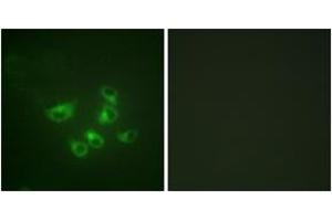 Immunofluorescence analysis of HepG2 cells, using Tryptophan Hydroxylase (Ab-58) Antibody. (Tryptophan Hydroxylase 1 Antikörper  (AA 26-75))