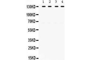 Western Blotting (WB) image for anti-Toll-Like Receptor Adaptor Molecule 1 (TICAM1) (AA 53-84), (N-Term) antibody (ABIN3043539) (TICAM1 Antikörper  (N-Term))