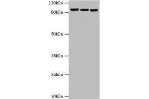 Western blot All lanes: Circadian locomoter output cycles protein kaput antibody at 6 μg/mL Lane 1: Hela whole cell lysate Lane 2: NIH/3T3 whole cell lysate Lane 3: 293T whole cell lysate Secondary Goat polyclonal to rabbit IgG at 1/10000 dilution Predicted band size: 95 kDa Observed band size: 95 kDa (CLOCK Antikörper  (AA 577-846))