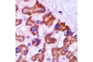 Immunohistochemistry (IHC) image for anti-Peroxisomal Biogenesis Factor 5 (PEX5) antibody (ABIN7308158) (PEX5 Antikörper)