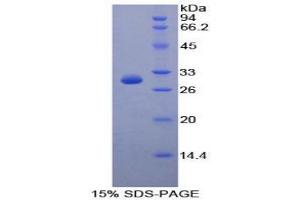 SDS-PAGE analysis of Human Protocadherin 1 Protein. (Protocadherin 1 Protein (PCDH1))